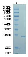 Reducing 12% SDS-PAGE and WB analysis profiles of purified PRL(CBB stained)